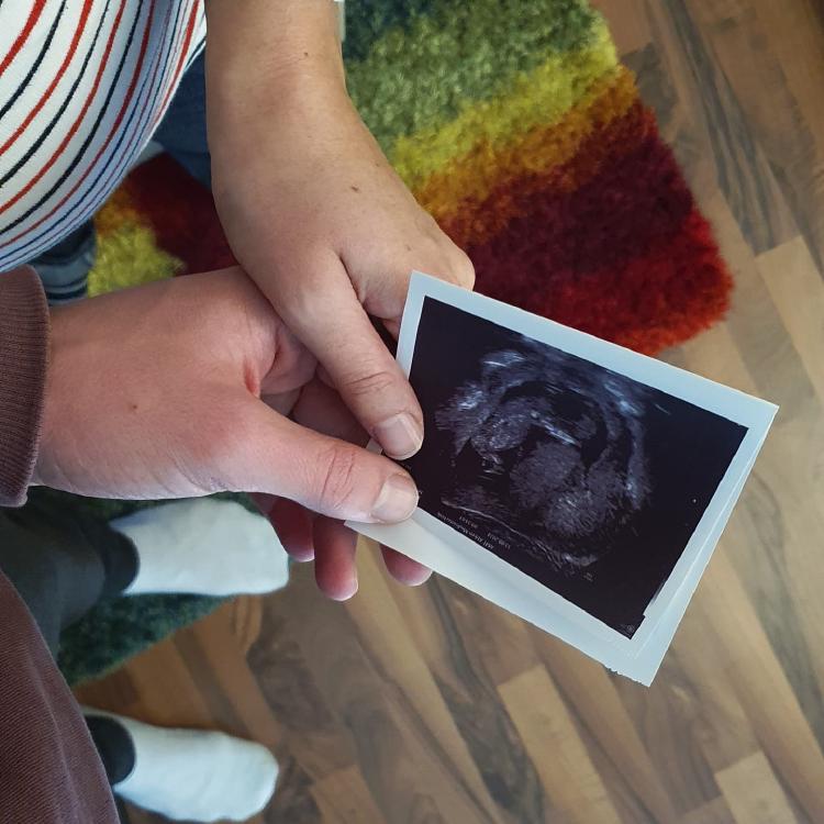 Eine Frau und ein Mann halten gemeinsam ein Ultraschallbild in ihren Händen.